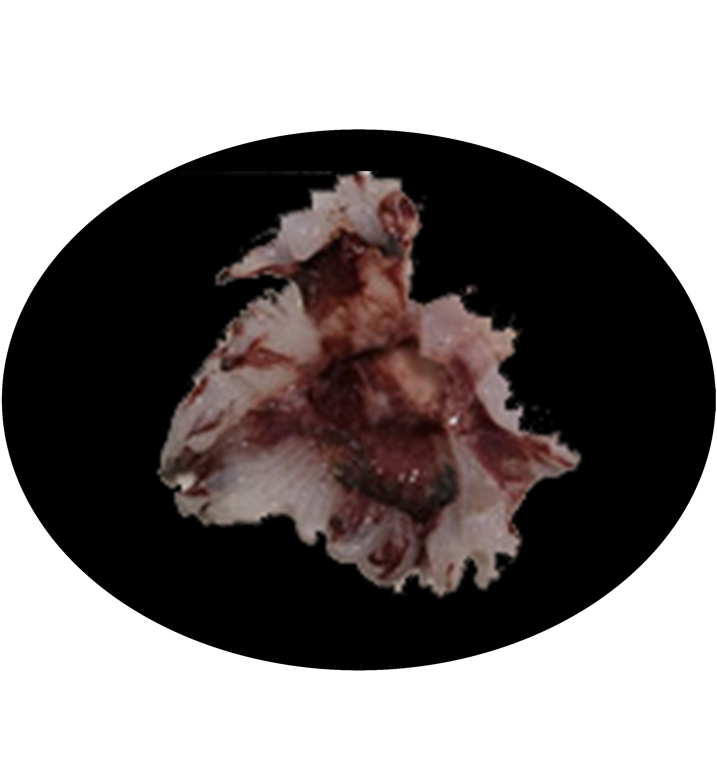 Asp1